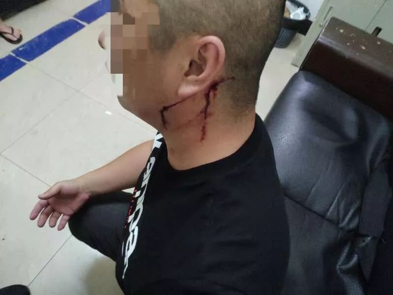 巡防队员算不算辅警_巡防队员是什么编制_巡防